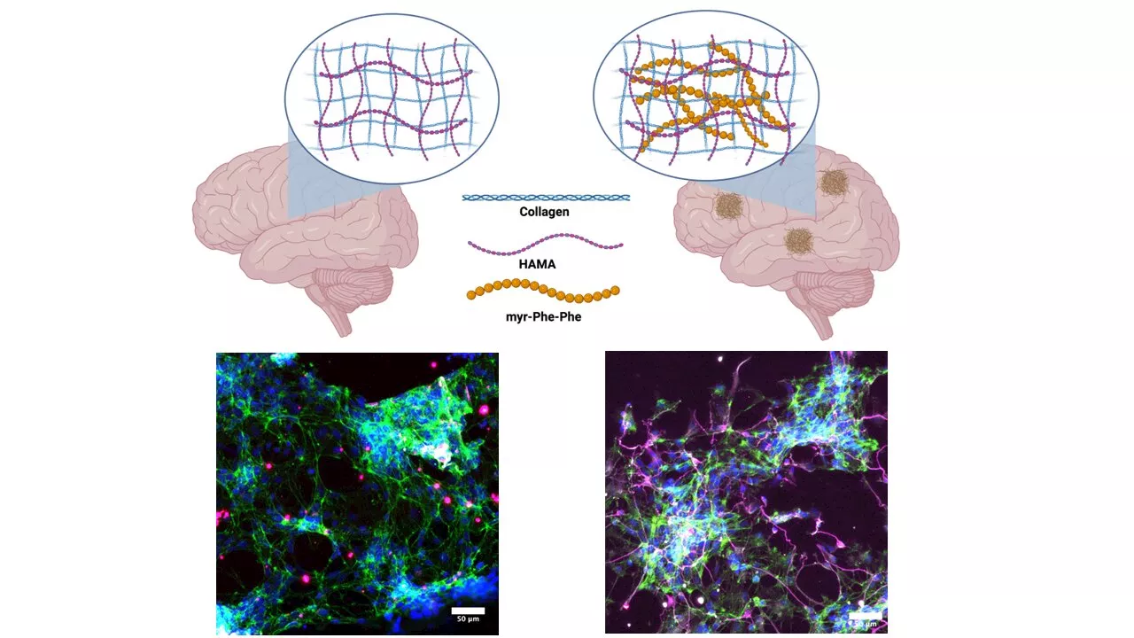 Study reveals insights into Alzheimer's disease mechanisms through novel hydrogel matrix