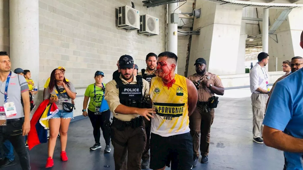 Insólito: diputado macrista culpó a los hinchas argentinos por la violencia en la final de la Copa América 2024