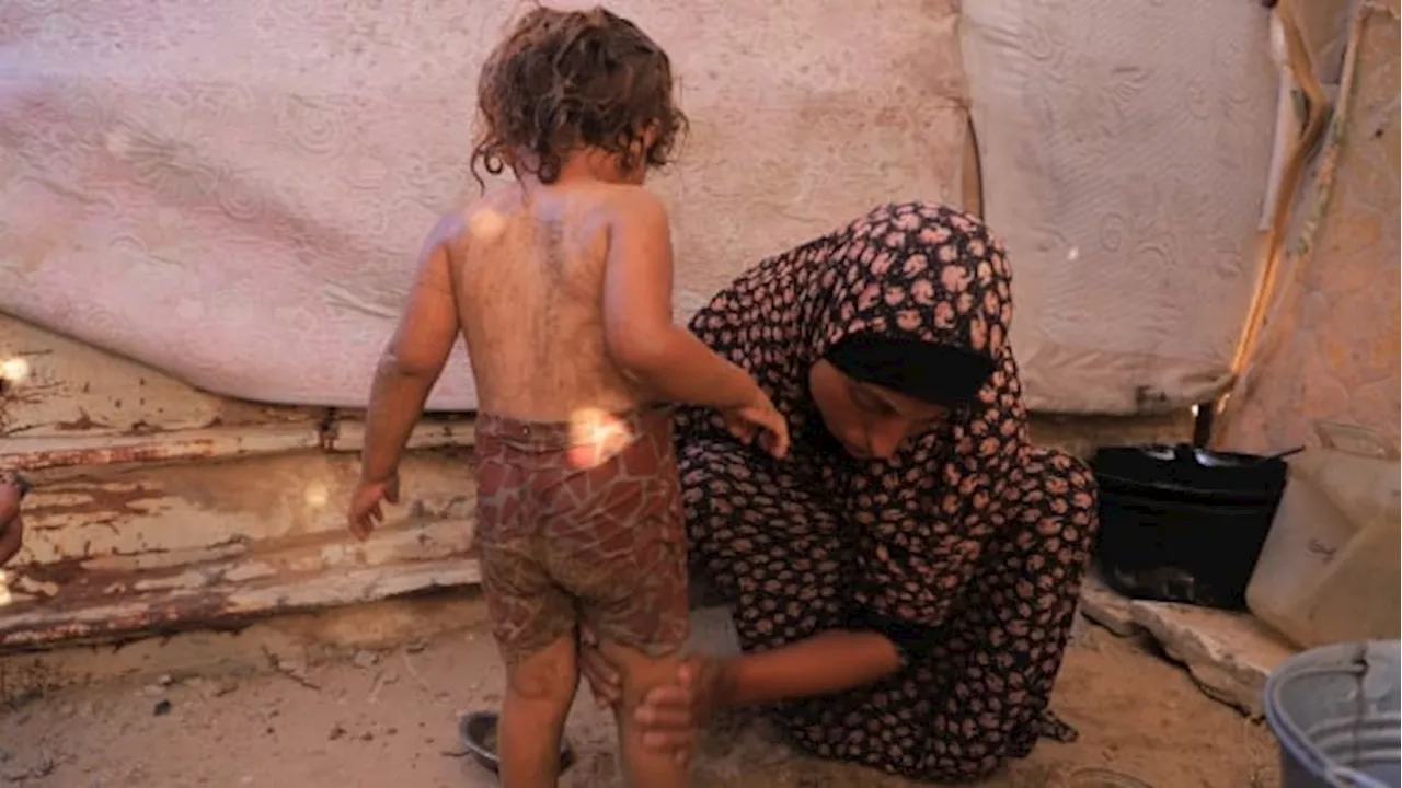 With a lack of access to aid, this mother in Gaza bathes her child with sand