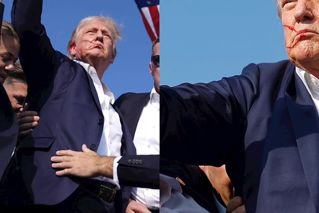 No, Trump was not shot in the chest, and debunking another false claim following assassination attempt