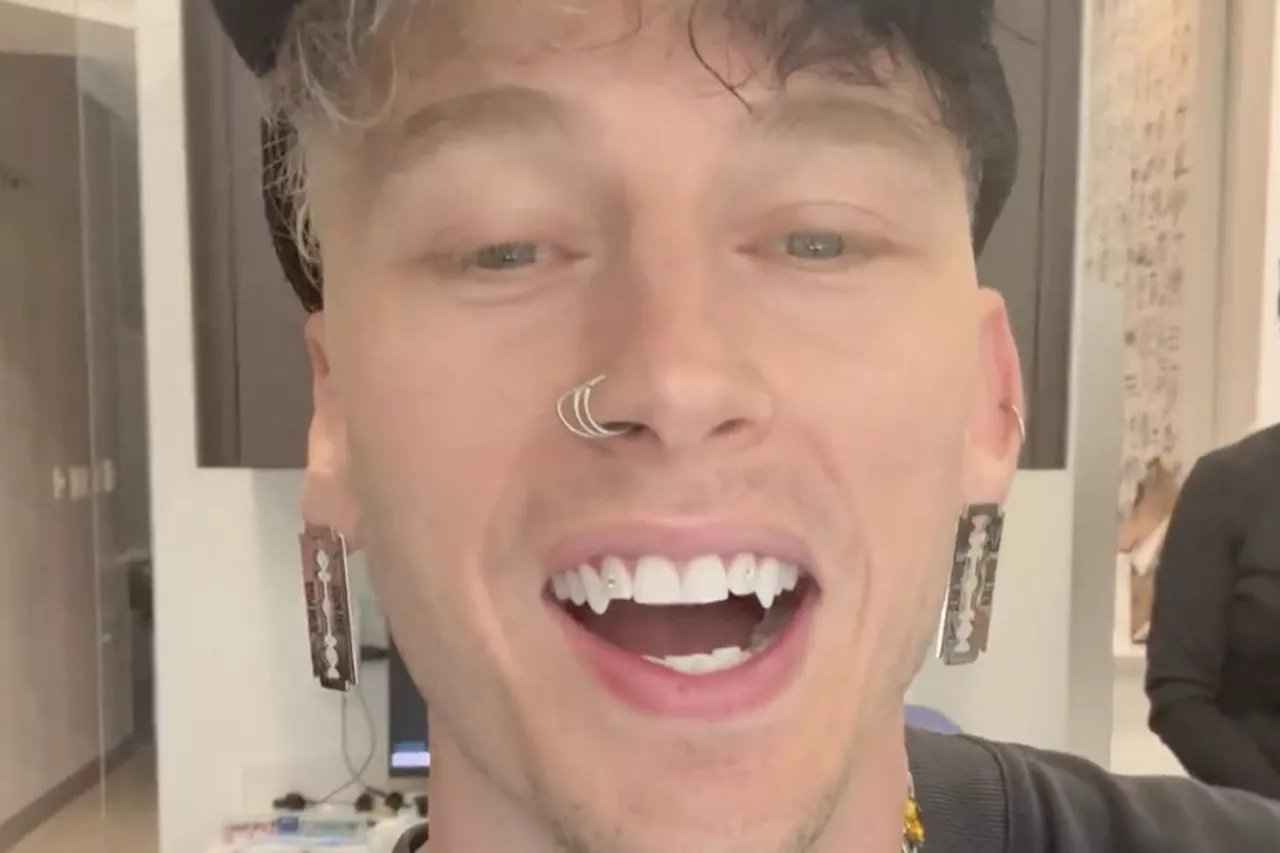 Machine Gun Kelly Debuts Fangs in Bold New Look: 'Might Need Em Sharpened'