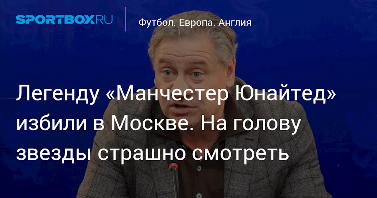 Легенду «Манчестер Юнайтед» избили в Москве. На голову звезды страшно смотреть