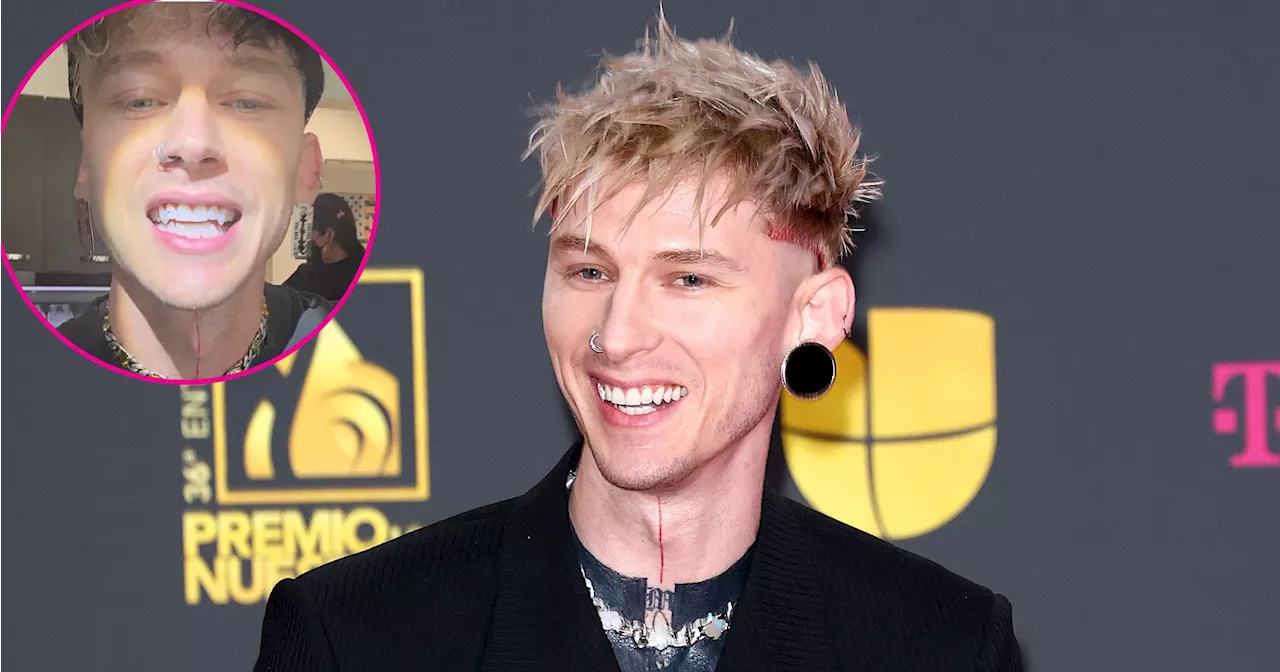 Machine Gun Kelly Shows Off New Fangs and Neck Tattoo