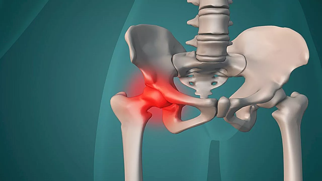 2016 to 2021 saw increase in number of periprosthetic fractures