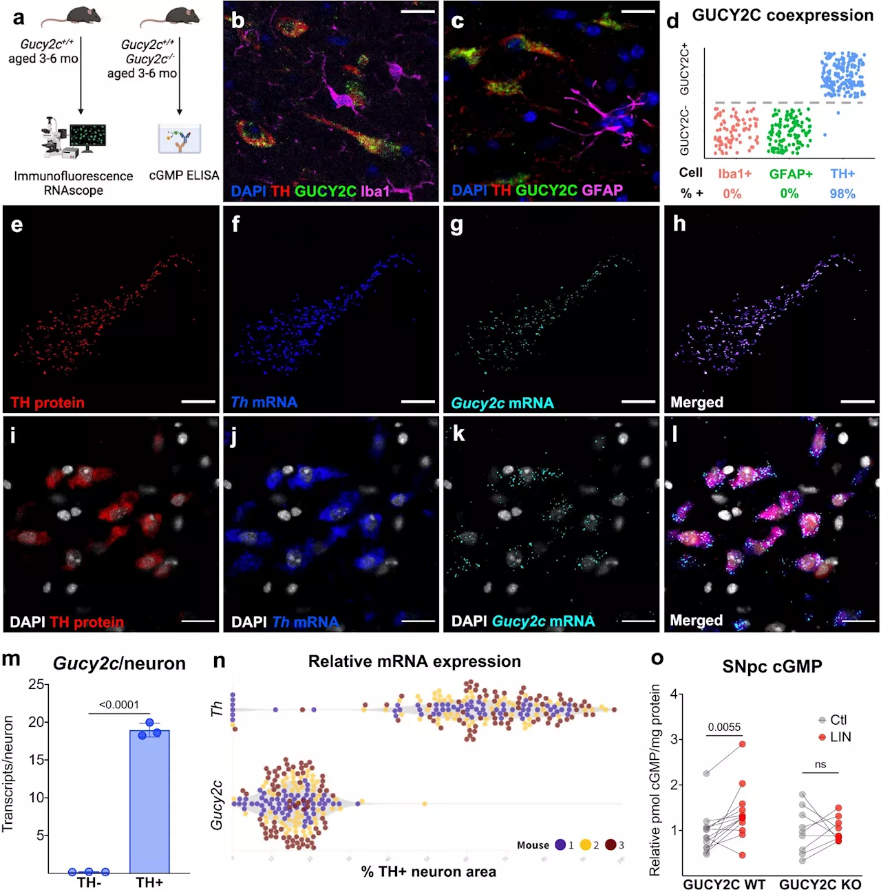 Gut protein may protect brain cells in Parkinson's disease