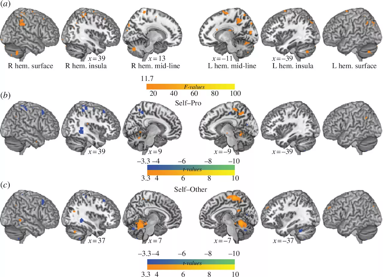 Researchers use MRI scans and karaoke to better understand the nature of blushing