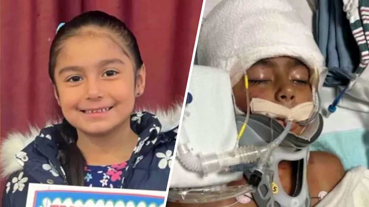 ‘She was mauled by an animal': Dog attack leaves 6-year-old in the ICU