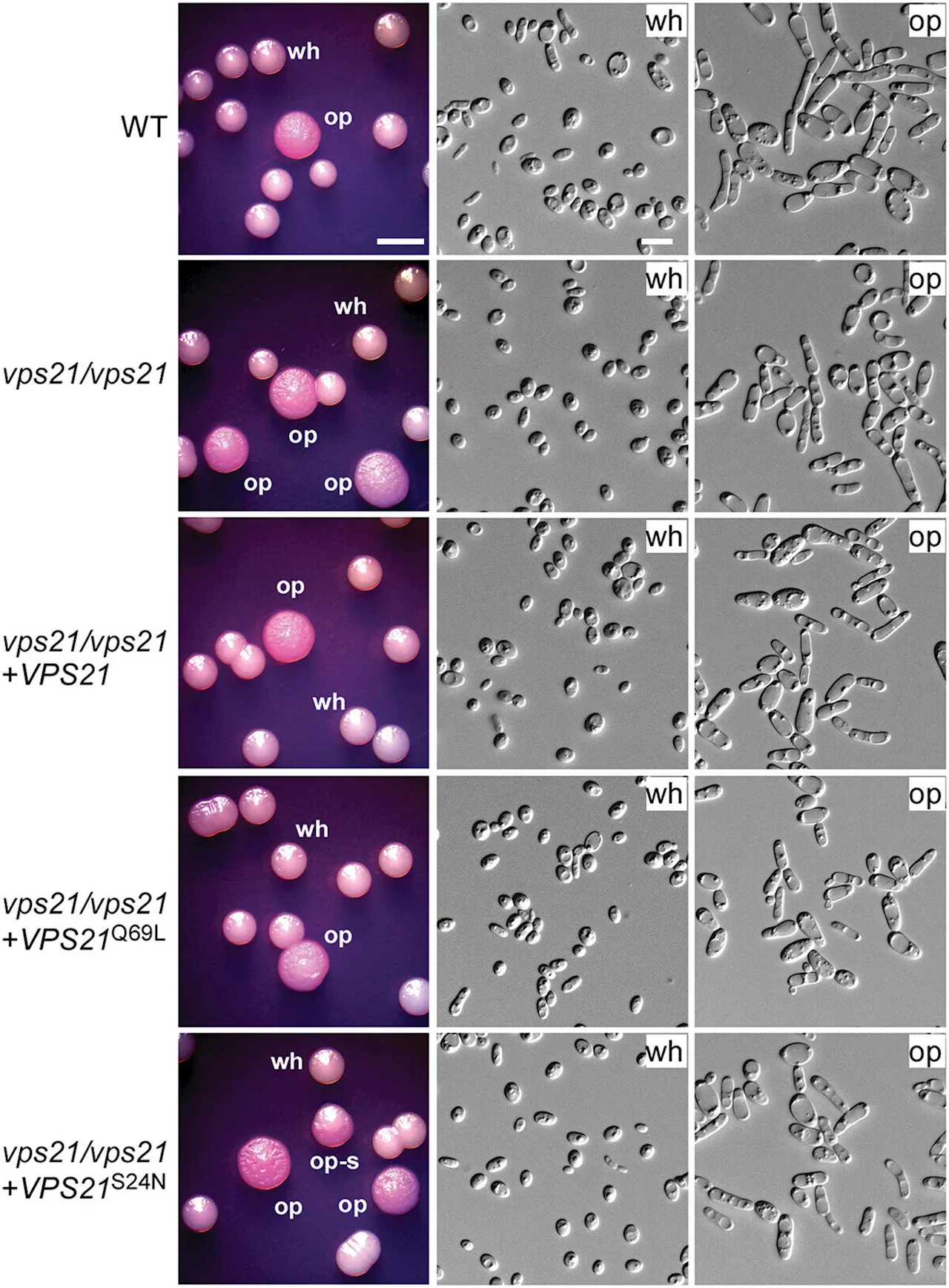 Study: Vps21 signaling pathway regulates white-opaque switching and mating in Candida albicans