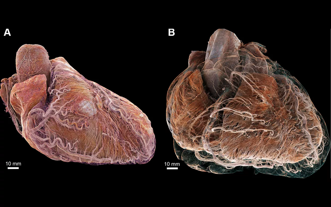 أول صورة ثلاثية الأبعاد لقلبين بشريين وصولاً إلى المستوى الخلوي