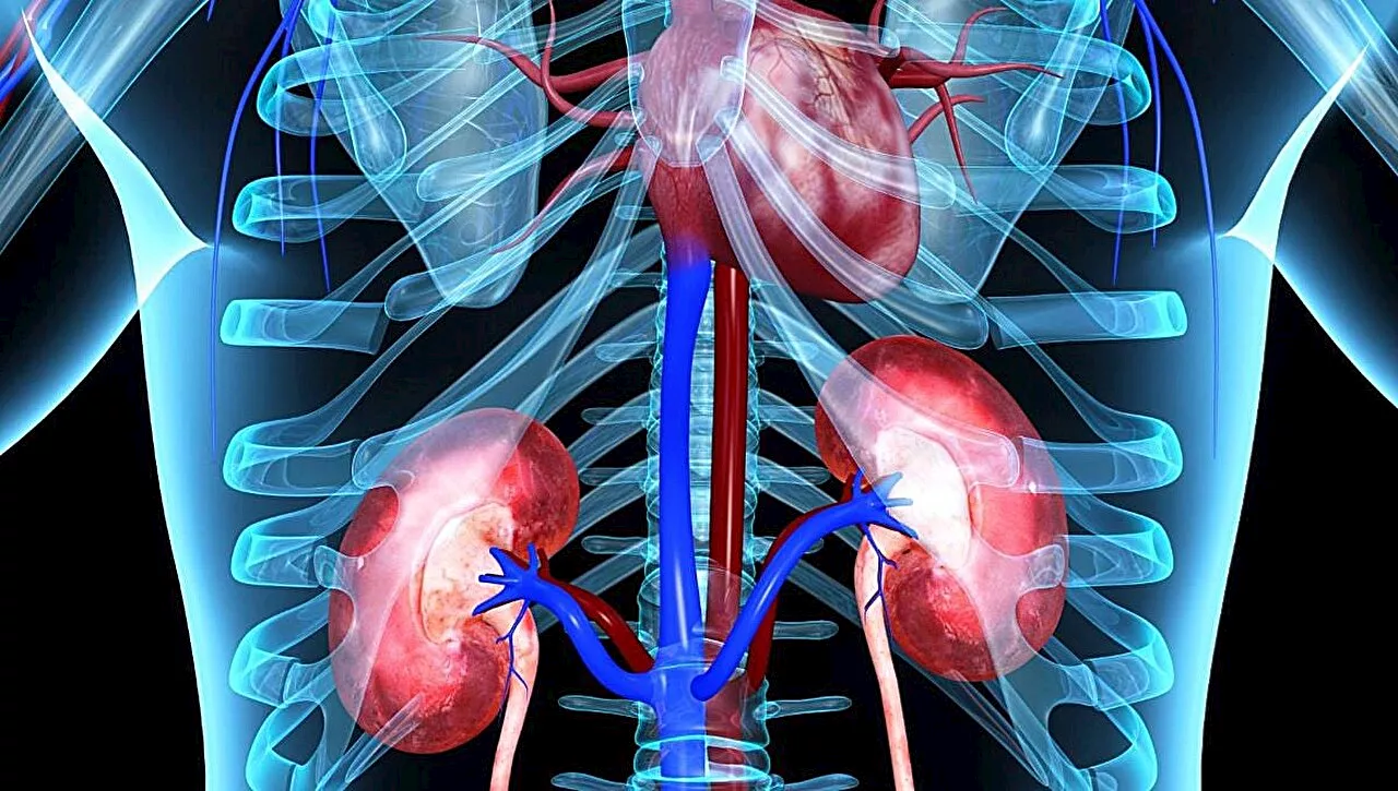 Digital subtraction angiography-guided TDC performance superior to ultrasound-guided TDC in renal replacement