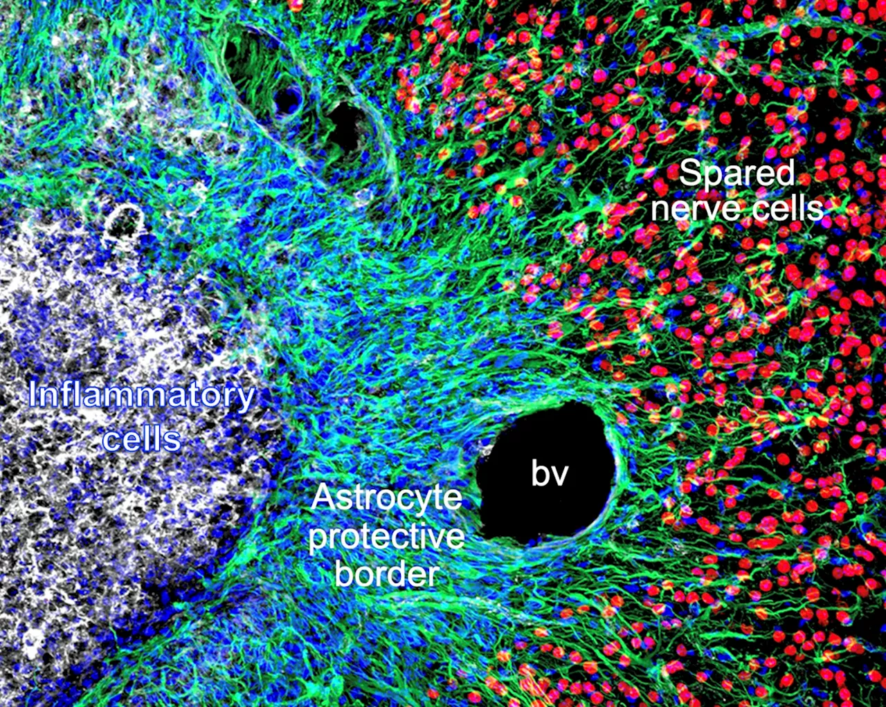 Exploring how astrocytes respond to spinal cord injury or stroke-induced tissue damage