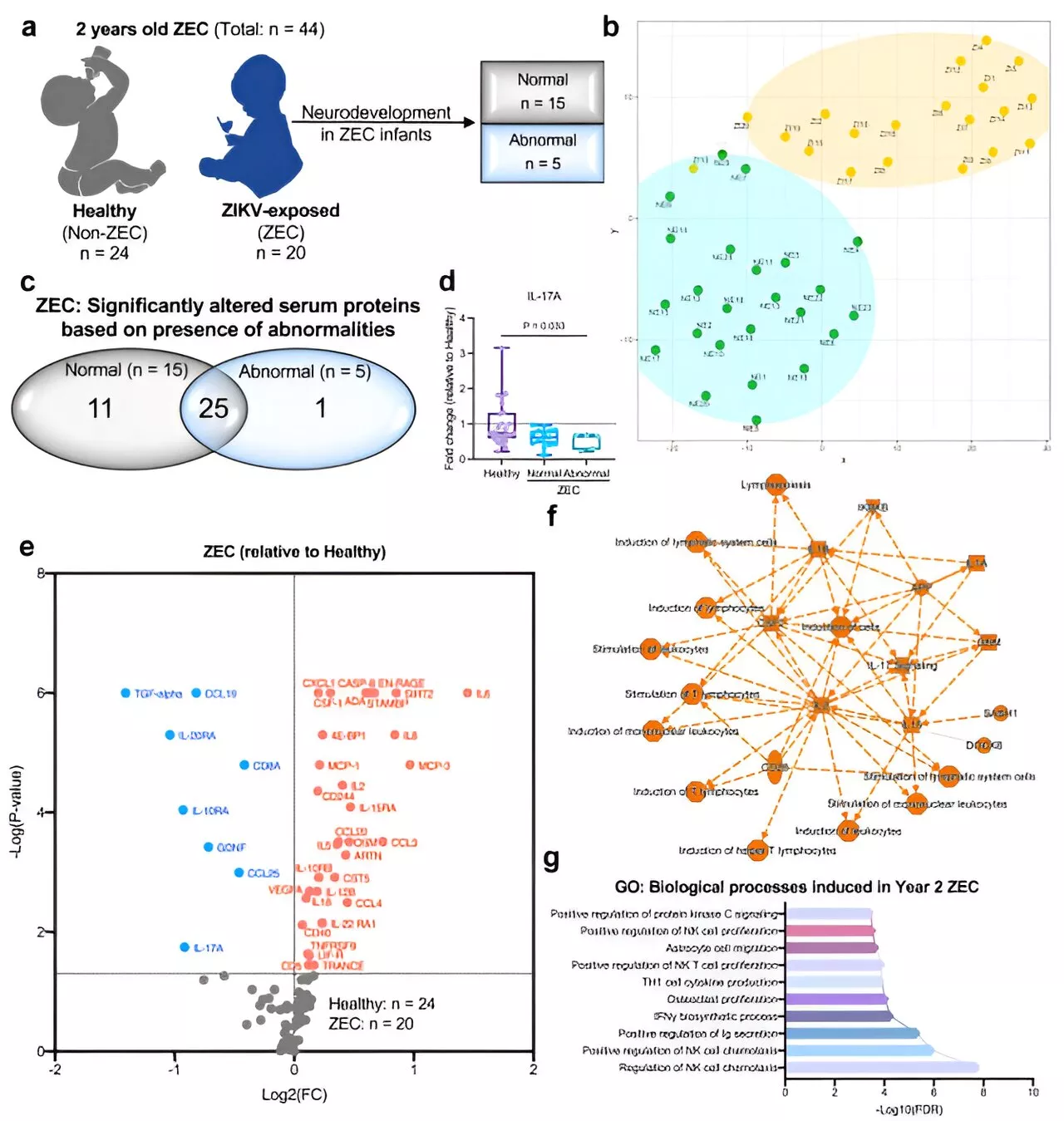 Prenatal Zika infection in mothers found to have long-term immune consequences in children, even without microcephaly