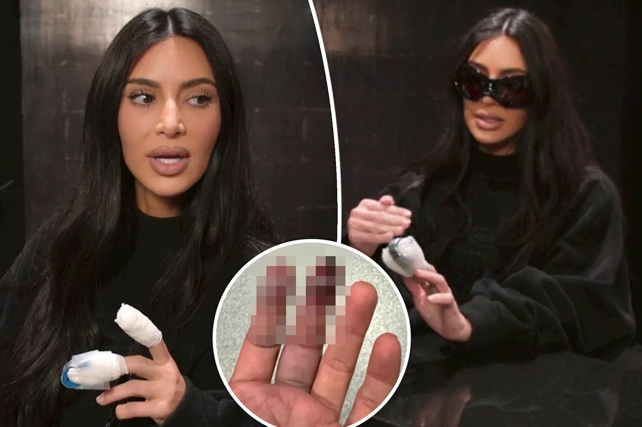 Kim Kardashian says sliding door caused gruesome finger injury: My bone was 'sticking out a little bit'