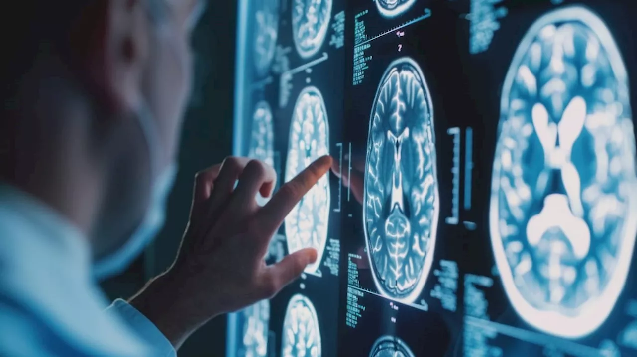 Cuatro hábitos que deterioran tu cerebro, según un estudio: el último aumenta el riesgo de demencia