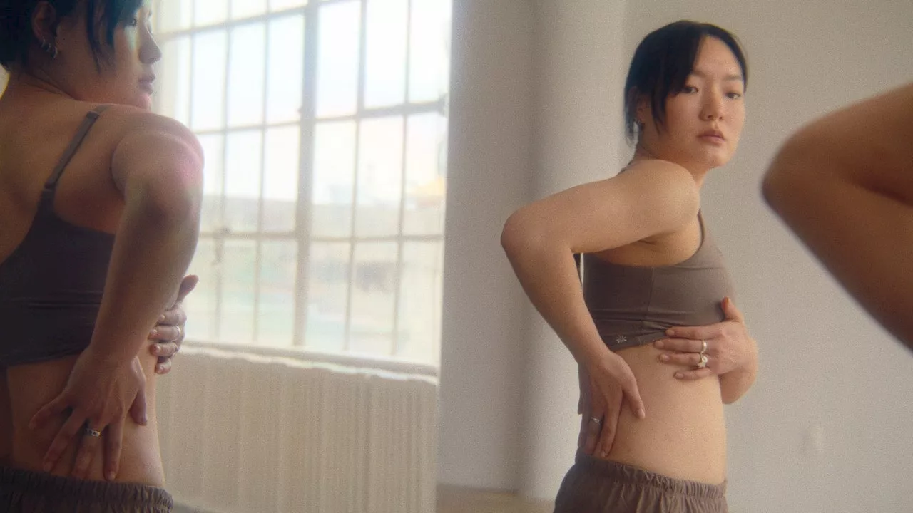 Why Dasol Kim Is Destigmatizing Psoriasis in the Dance Community