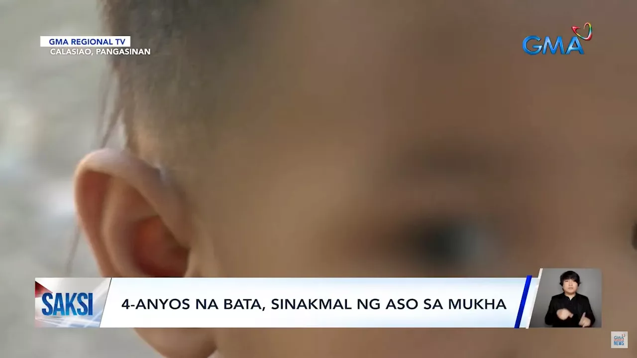 4-year-old boy survives dog attack in Pangasinan