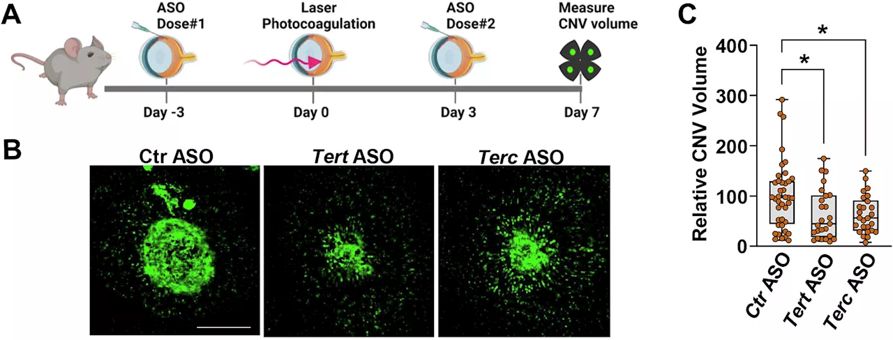 A new target for treatment of one type of macular degeneration