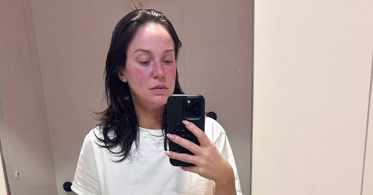 Vicky Pattison issues health update after discharged from 'scary' hospital stay