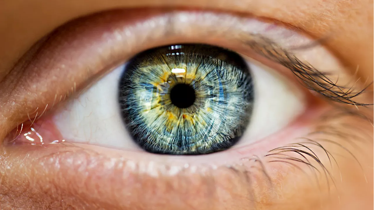 Study hints at possibility of new treatment for a type of macular degeneration