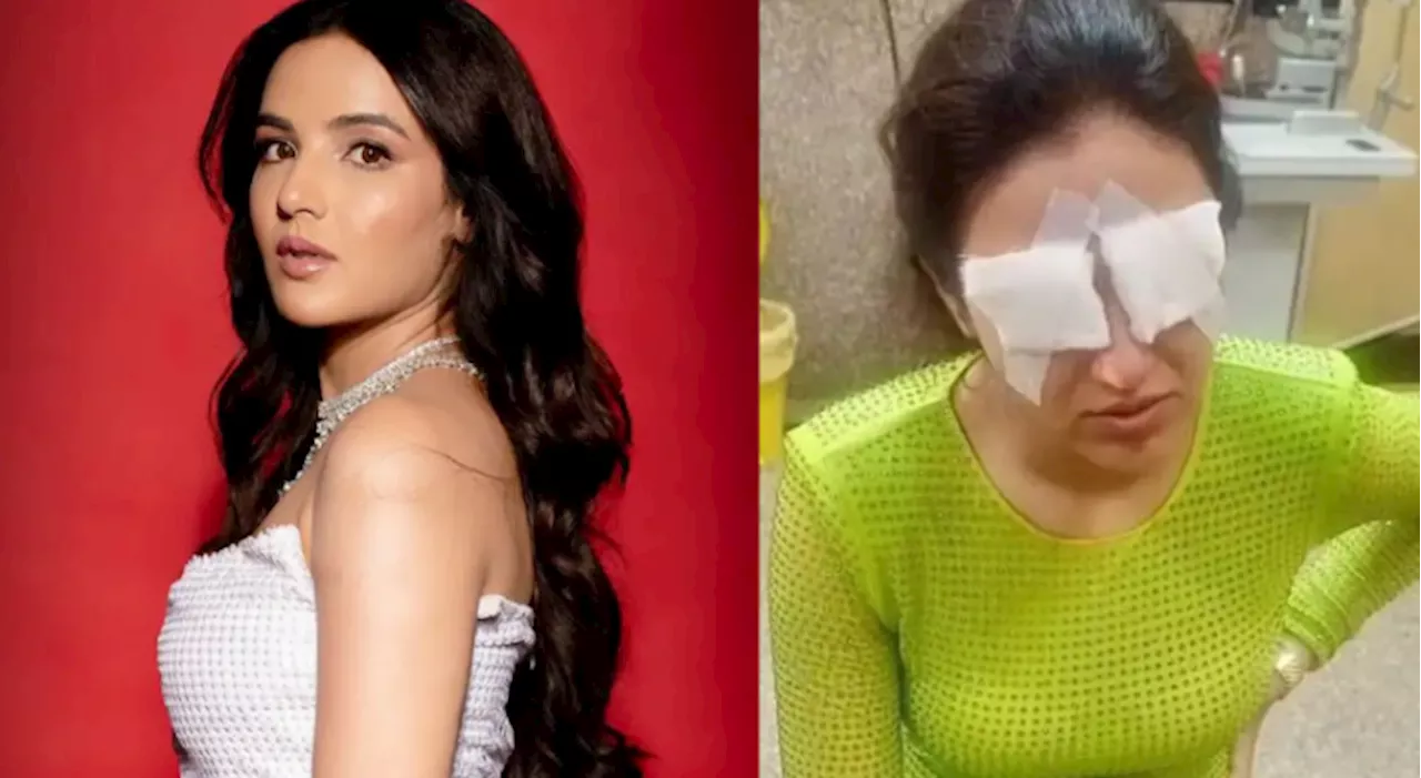 Jasmin Bhasin endures severe eye damage from contact lenses