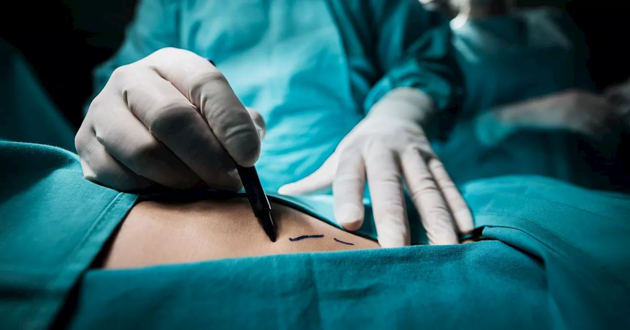 €10m spent on facelifts, lipo, breast augmentation in state hospitals since 2021