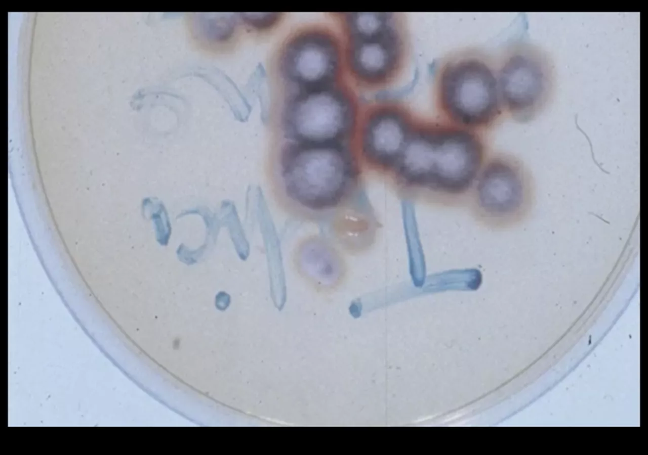 New Type of Fungal Infection Claims Two Lives in China