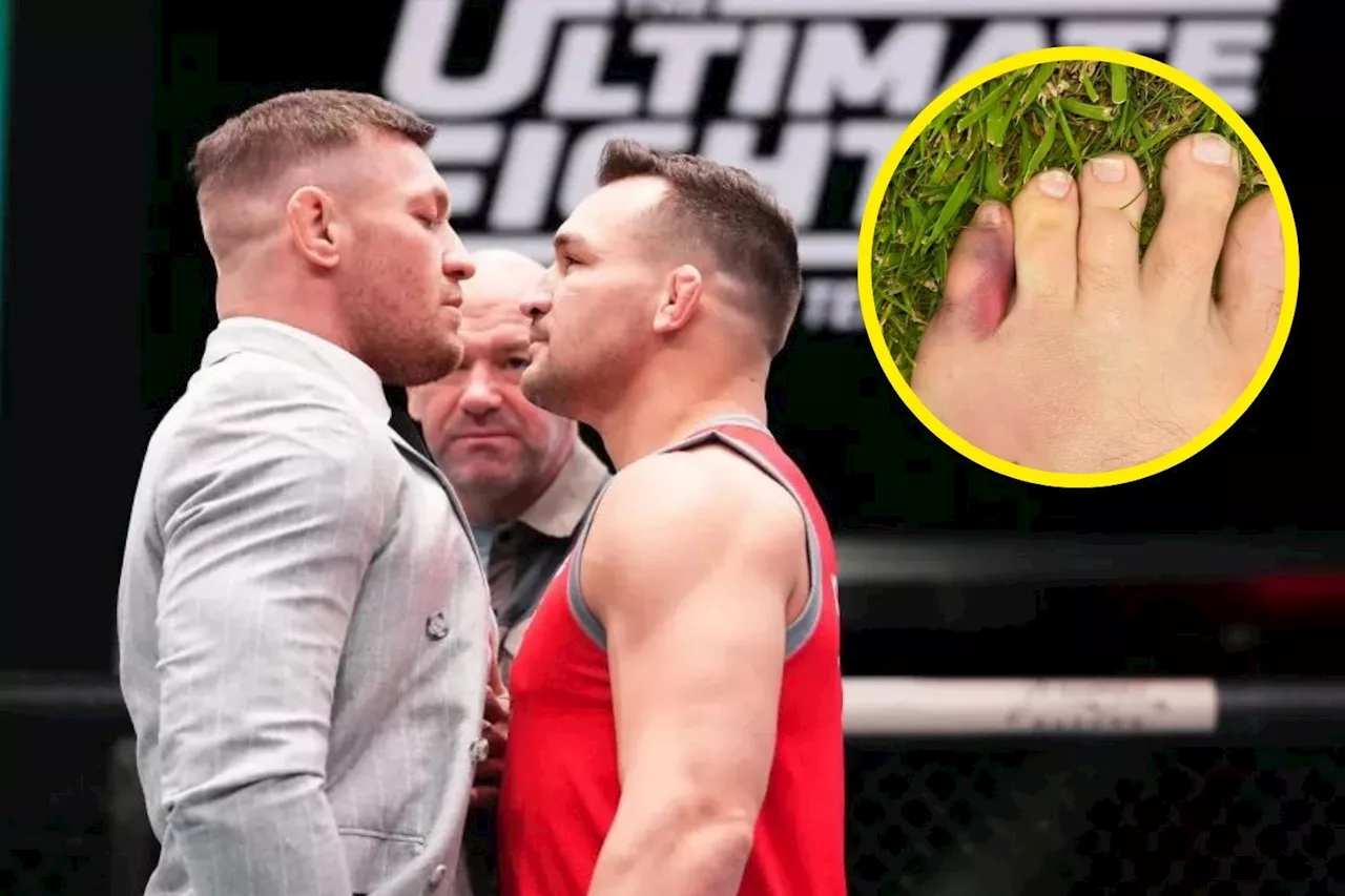 Conor McGregor provides major injury update after being probed by ‘bum beggar’ Michael Chandler...