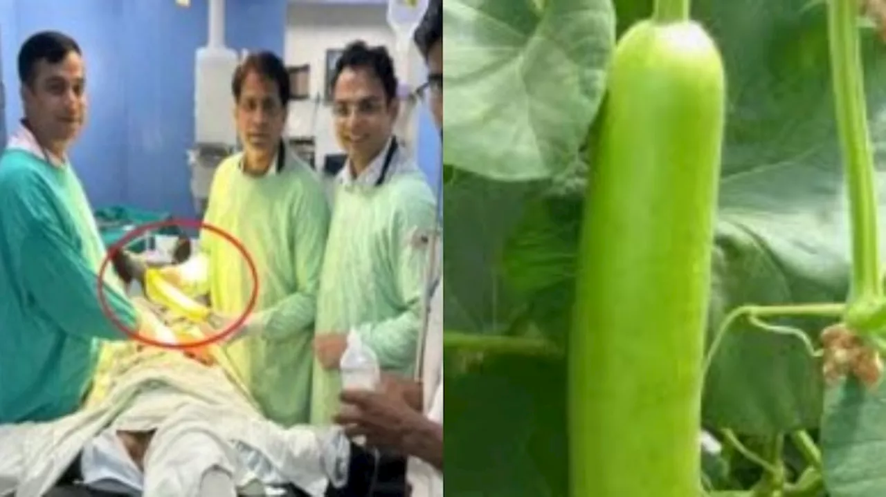 Bottle gourd: ఇదేం విడ్డూరం.. యువకుడి పొట్టలో తొడిమతో ఉన్న సోరకాయ.. అసలేం జరిగిందంటే..?