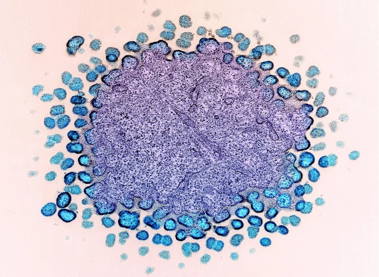 Remédio promissor contra o HIV poderia custar até mil vezes menos na versão genérica, segundo especialistas
