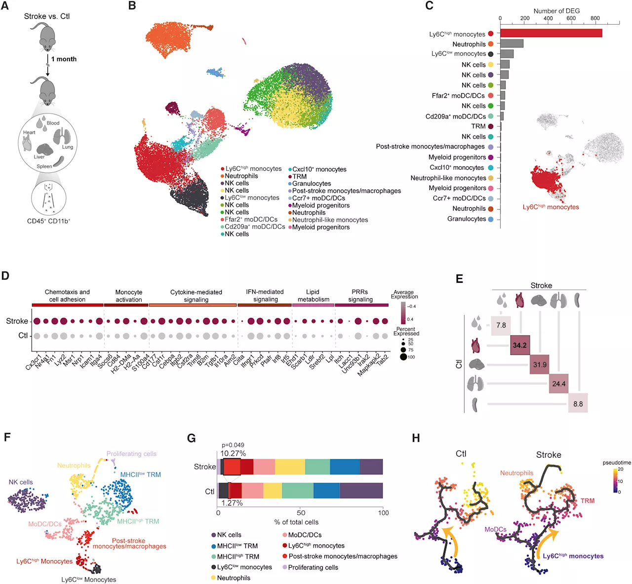 Brain-heart axis study finds strokes change epigenetics of immune system
