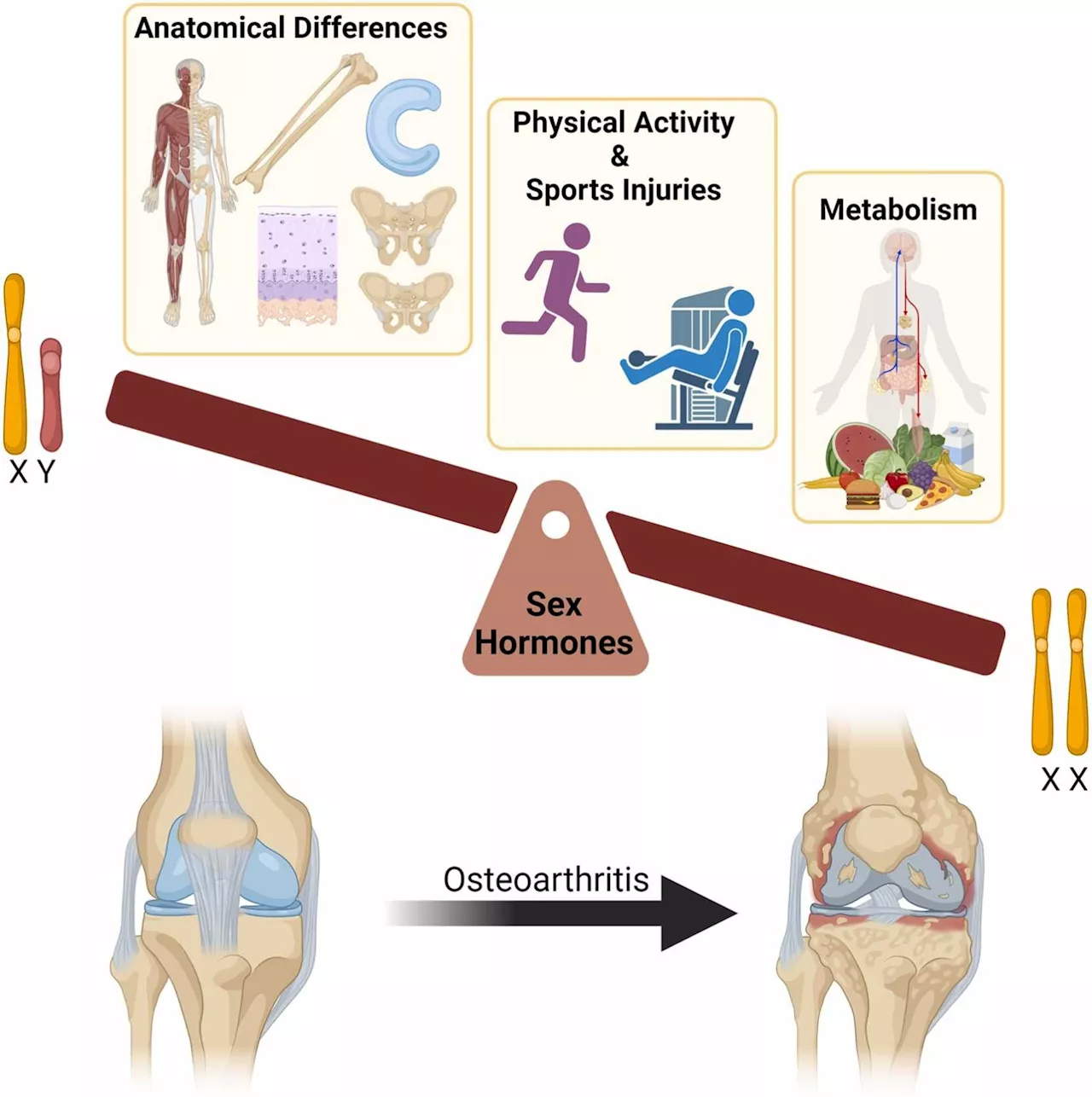 Females' osteoarthritis risk should be addressed early in life, says study