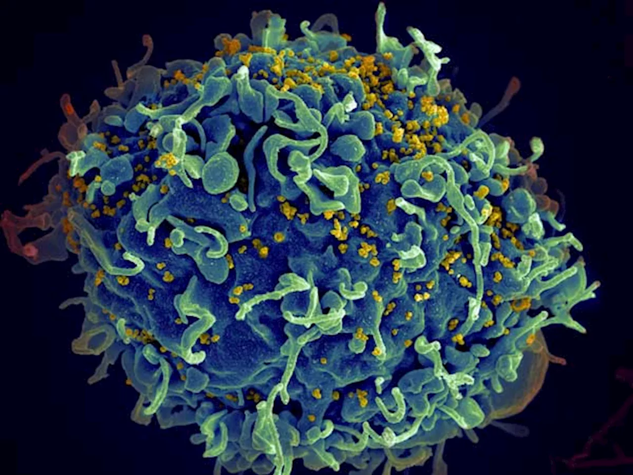 New 'vaccine-like' HIV drug could cost just $40: Researchers