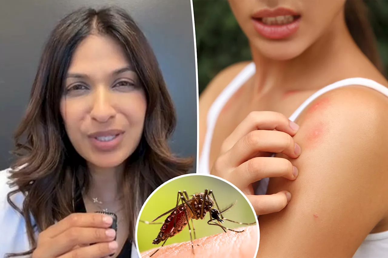 I'm a doctor — this is the easiest way to heal mosquito bites fast