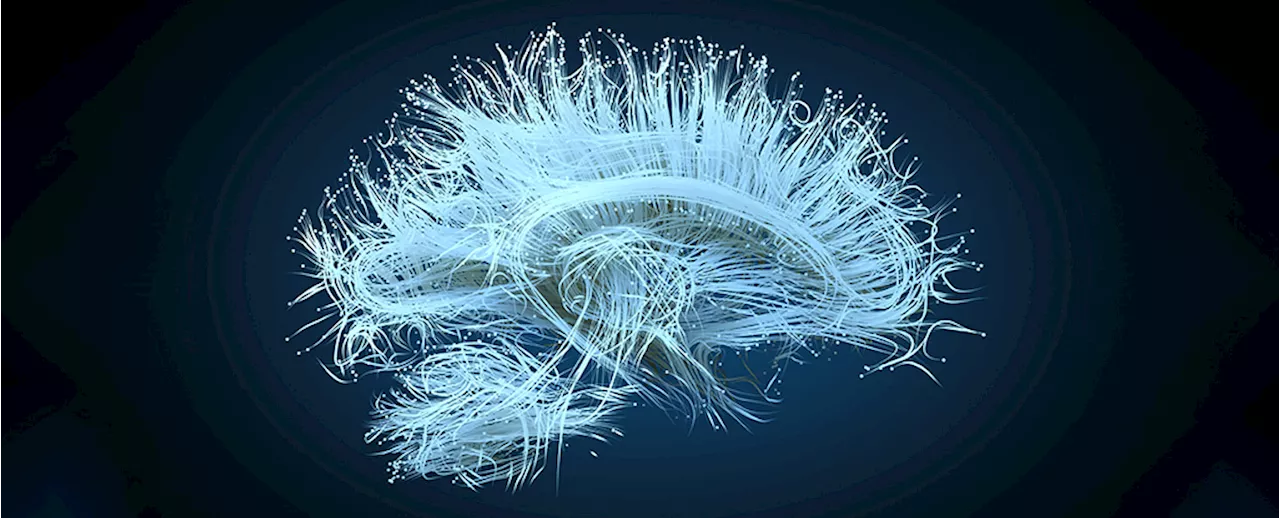 Sex And Gender Show Distinct Variations in Brain Connectivity