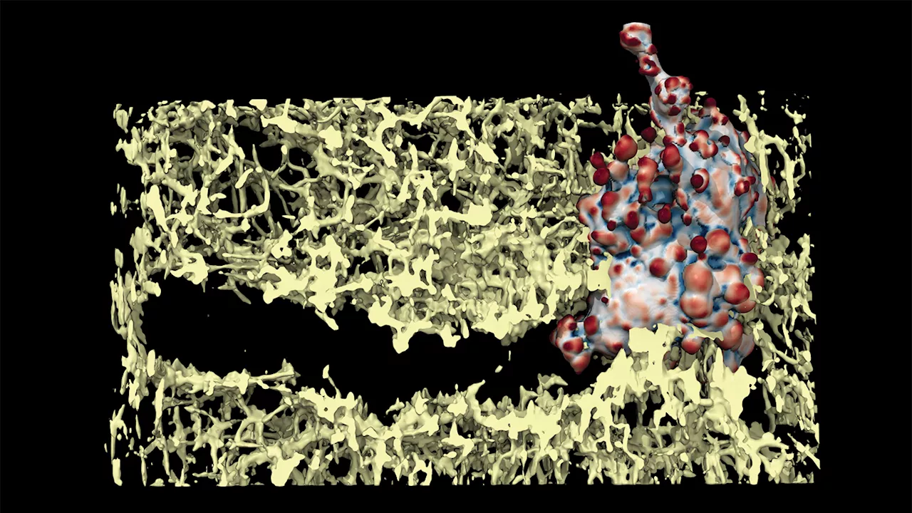 Some melanoma cancer cells may punch their way through the body