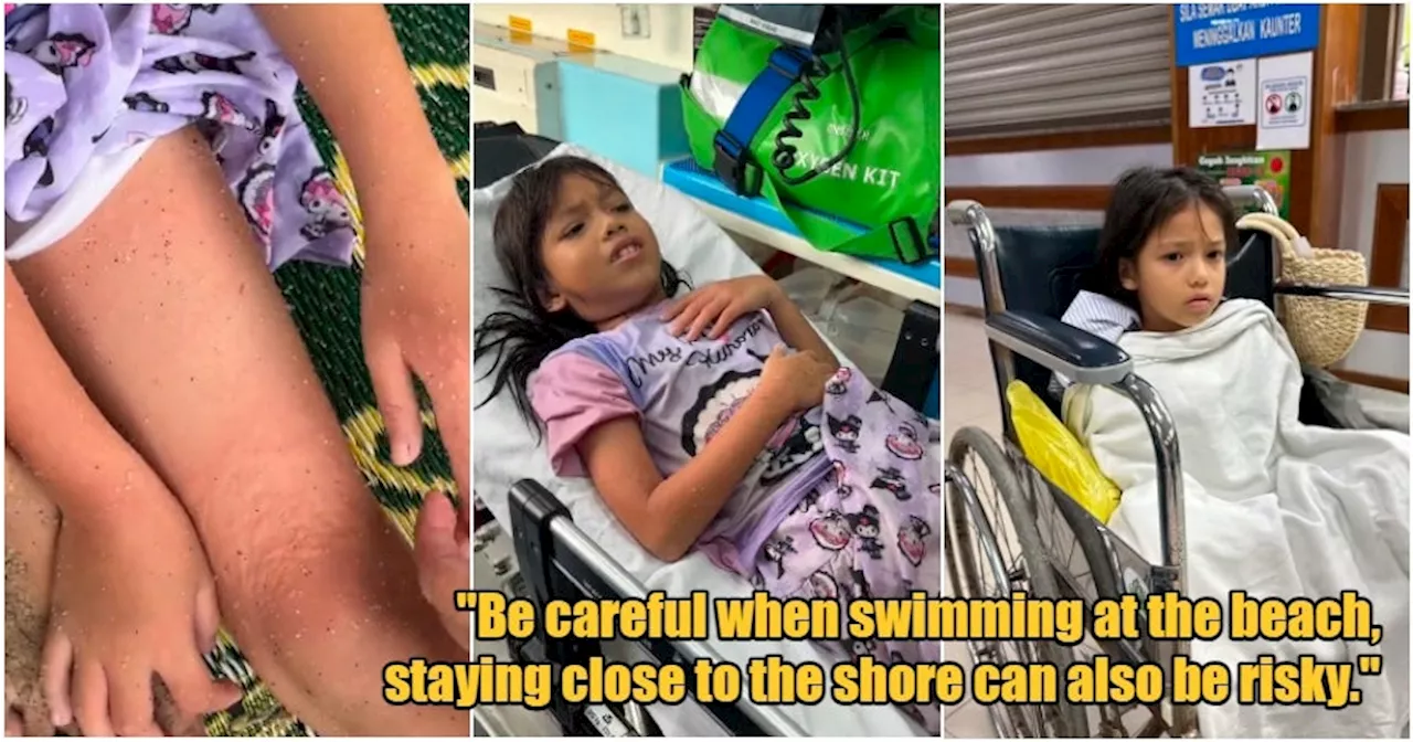 9yo M'sian Girl Experiences Sharp Pain & Itchiness After Visit to Batu Ferringhi Beach