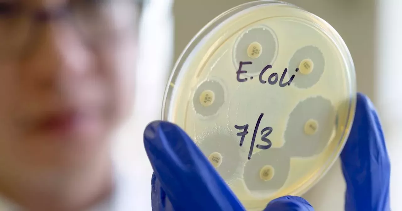 Doctor's warning as common item 'increases E. coli and salmonella risk'