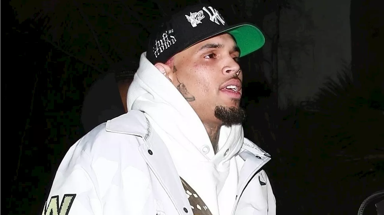  Millionen-Klage! Chris Brown soll Fans verprügelt haben