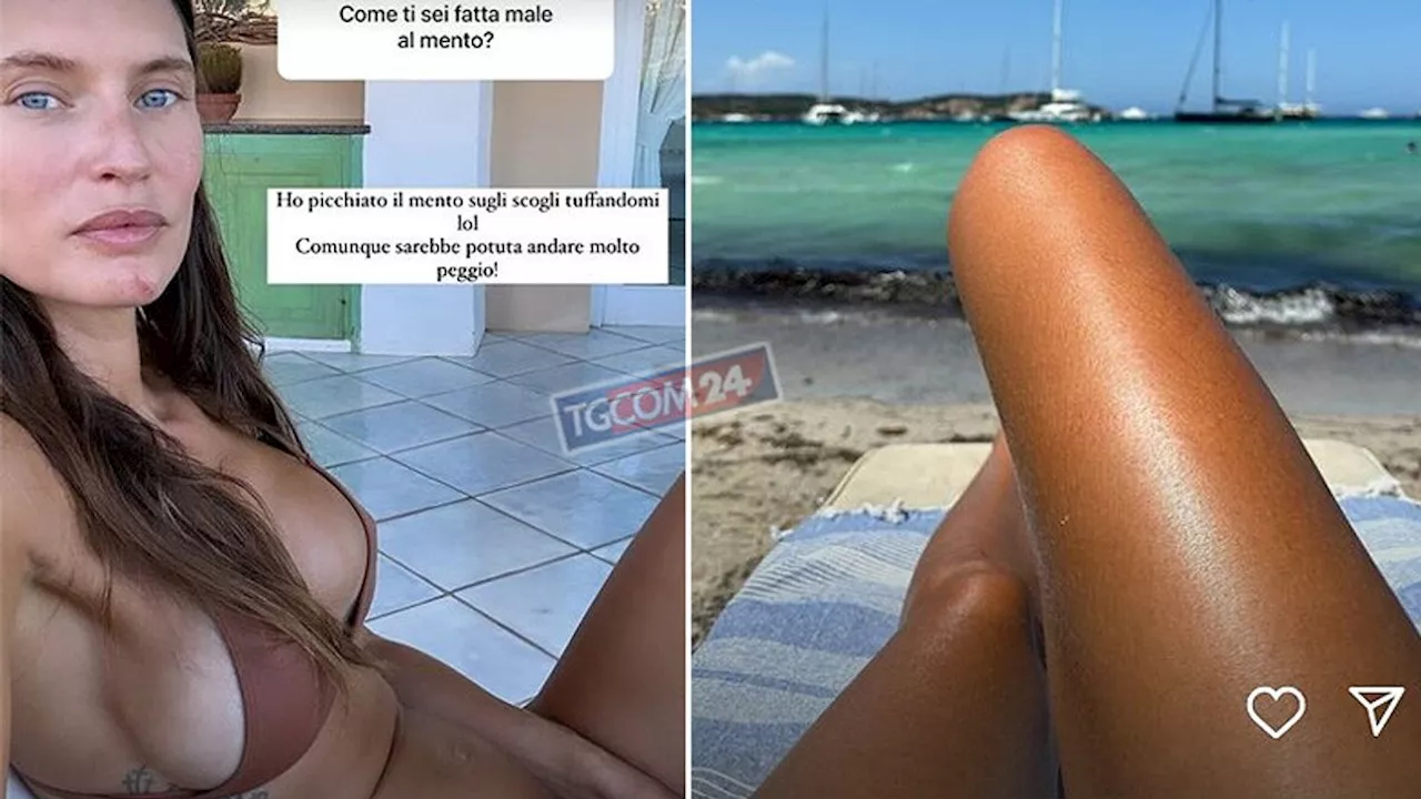 Bianca Balti si ferisce a Porto Cervo: “Poteva andare peggio”