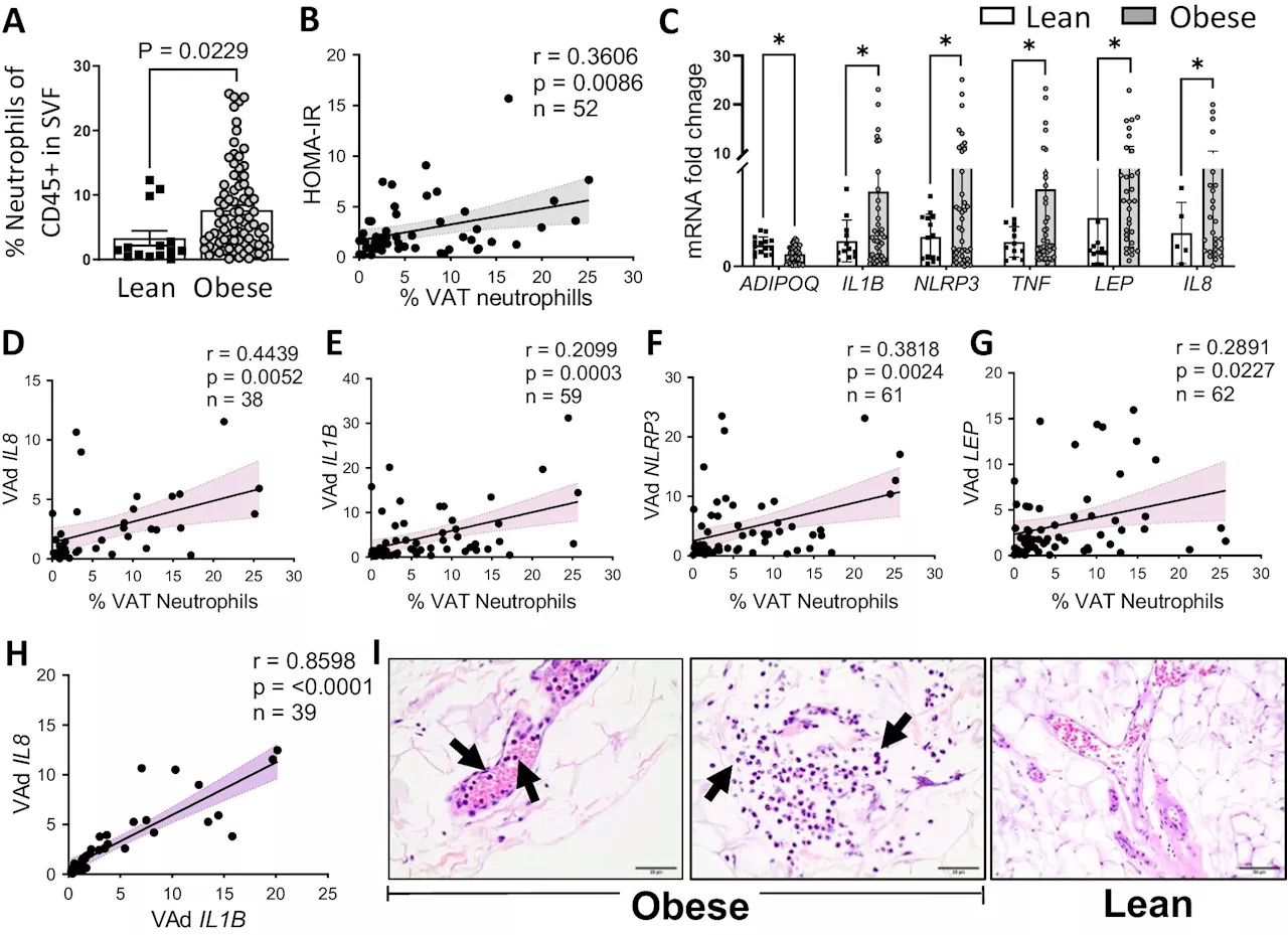 Study finds obese patients have more neutrophils than those who are not obese