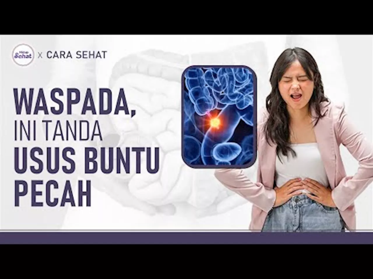 Usus Buntu Pecah Bisa Fatal, Ini Tips Mengenali Gejalanya