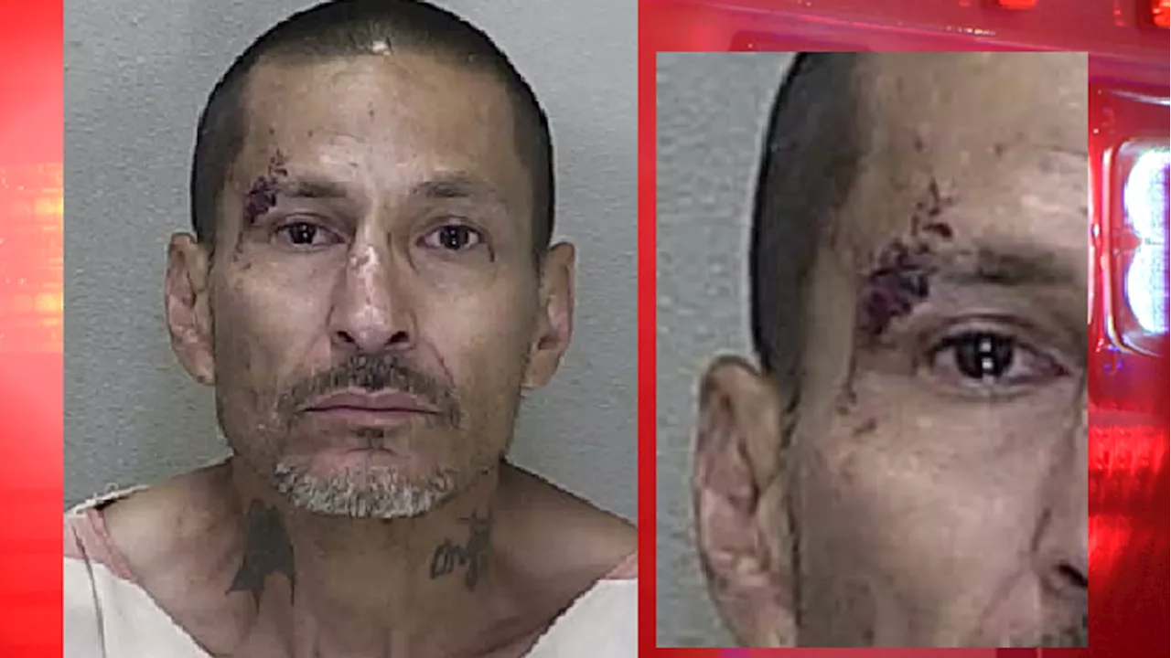 Gas station gash: He hit worker in the face with M&Ms but faces felonies for fighting cop