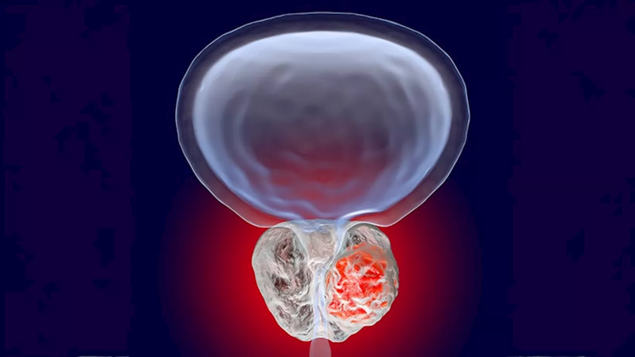 Baseline Bone Pain Predicts Survival in Metastatic Hormone-Sensitive Prostate Cancer