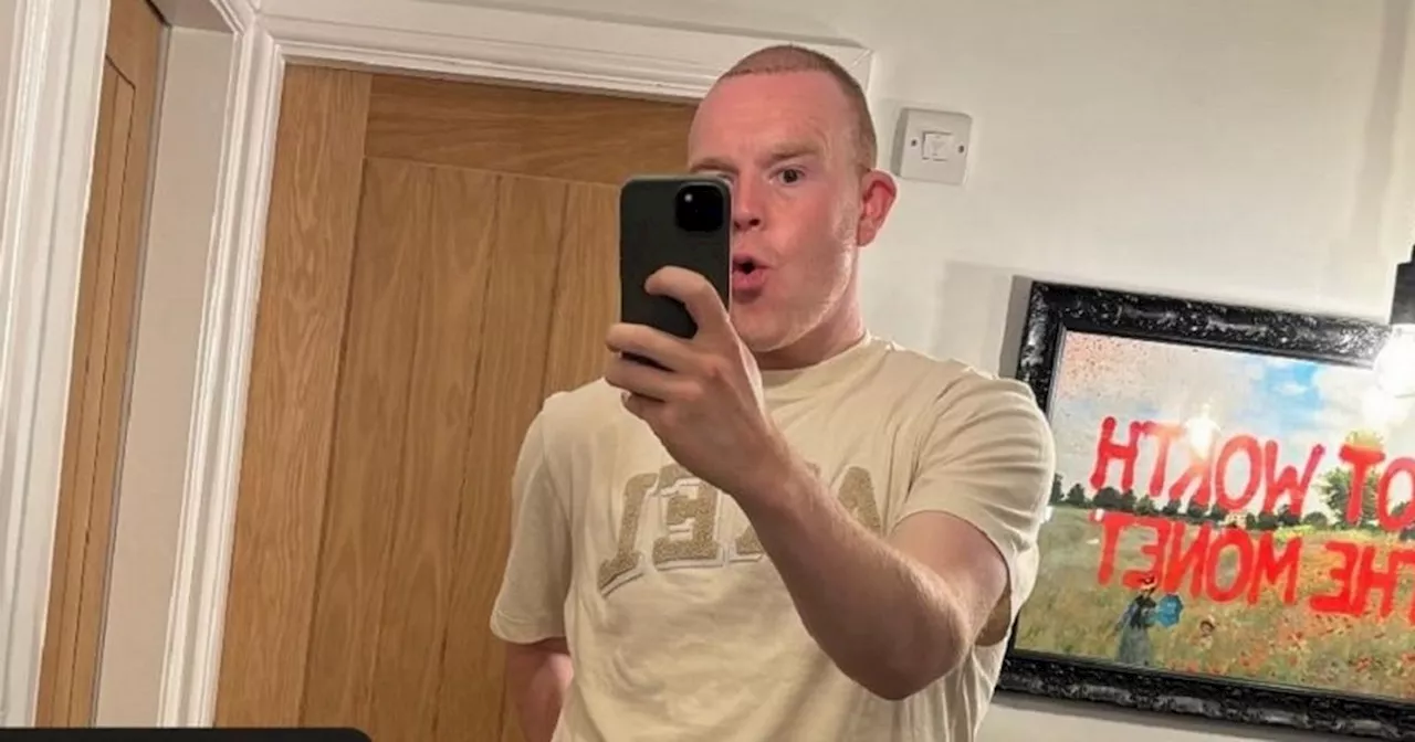 Corrie's Colson Smith 'getting used to it' in update after hair transplant