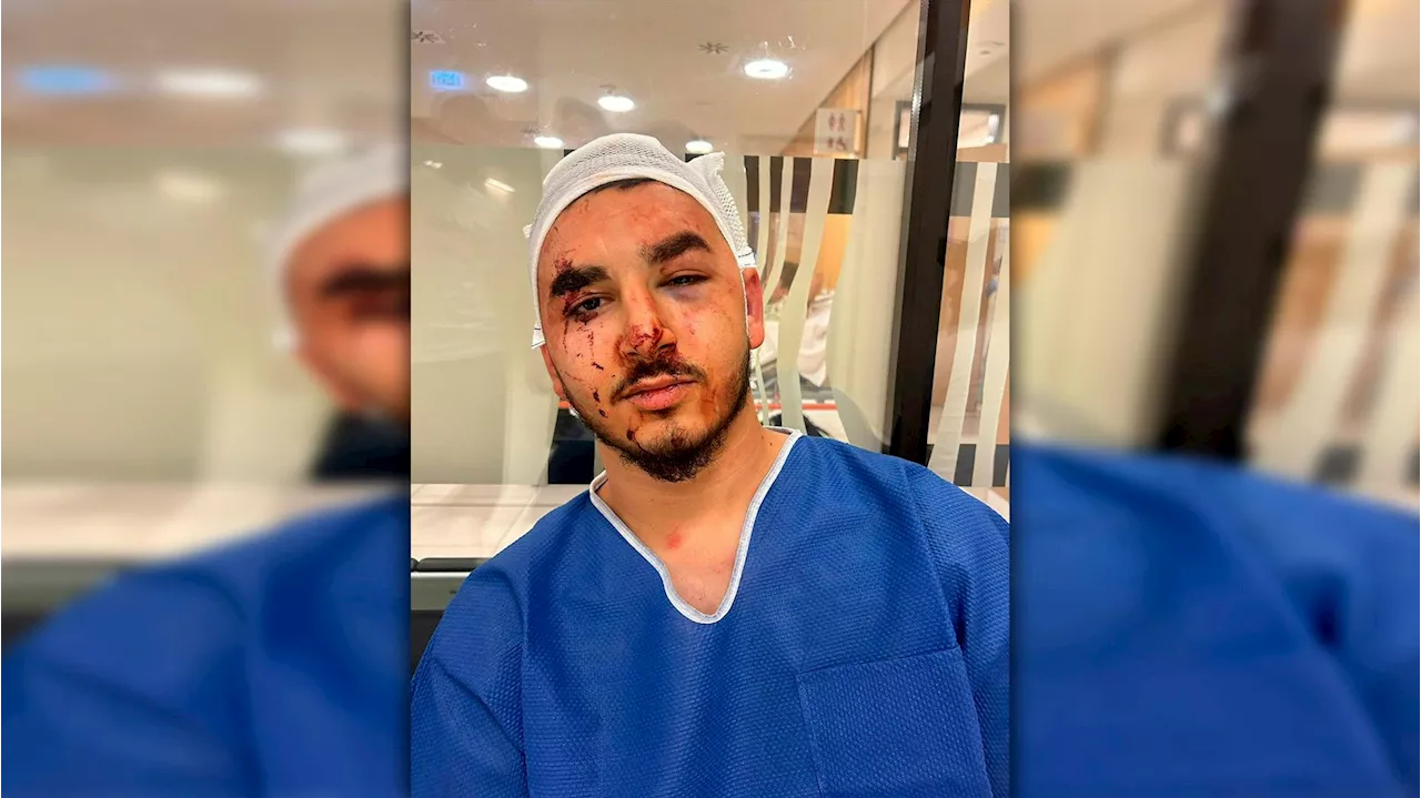 Zweite Attacke in einer Woche - 20-Jähriger brutal verprügelt, weil er Türkisch spricht