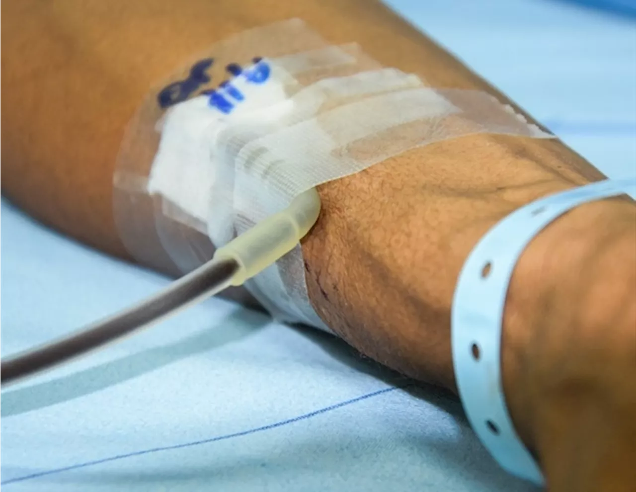 Study: Iron infusions superior to blood transfusions for surgical patients with anemia