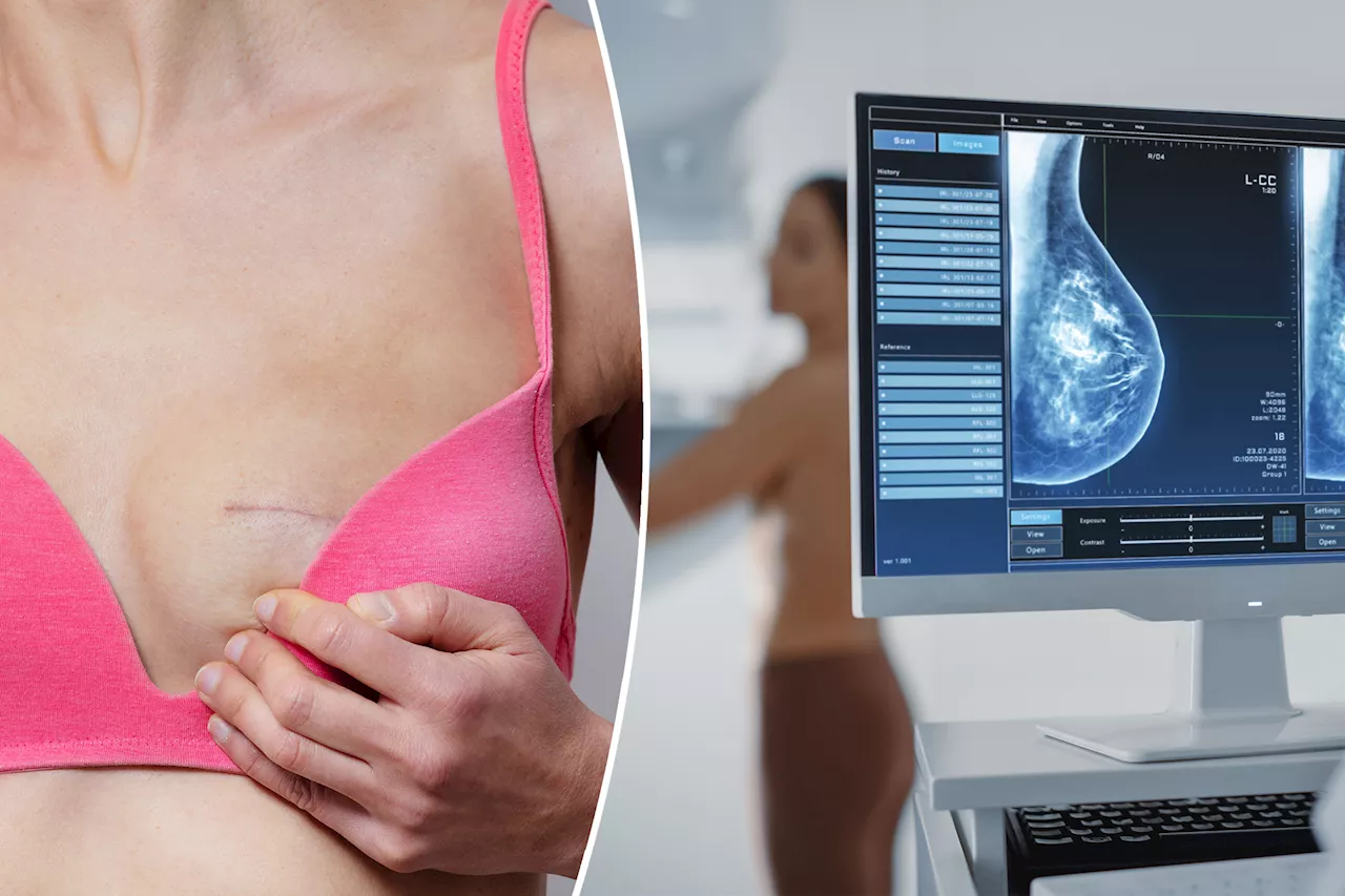 A double mastectomy to beat breast cancer will not improve chances of survival, study reveals