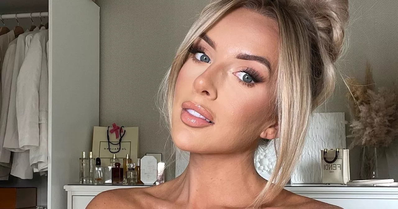 Love Island’s Faye Winter shows 'real skin' and shares 'embarrassing' condition