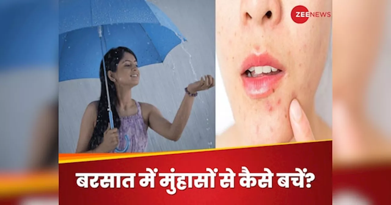 Monsoon Skin Care: बरसात के मौसम में चेहरे की त्वचा को ऐसे रखें हाइड्रेट, वरना आ सकते हैं मुंहासे