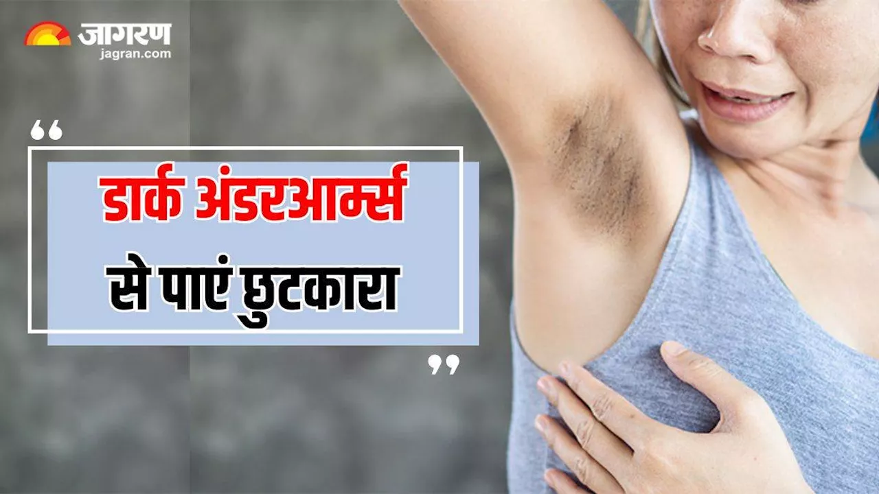 स्लीवलेस ड्रेस पहनने से रोक रहे हैं Dark Underarms, तो इन्हें ब्राइट बना सकती हैं घर पर रखी 5 चीजें